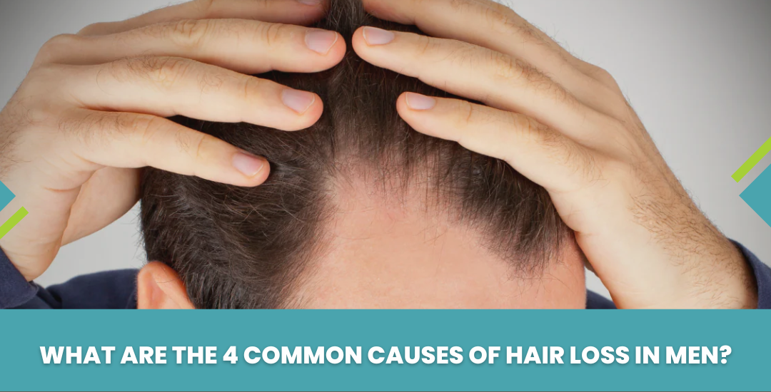 What are the 4 Common Causes of Hair Loss in Men