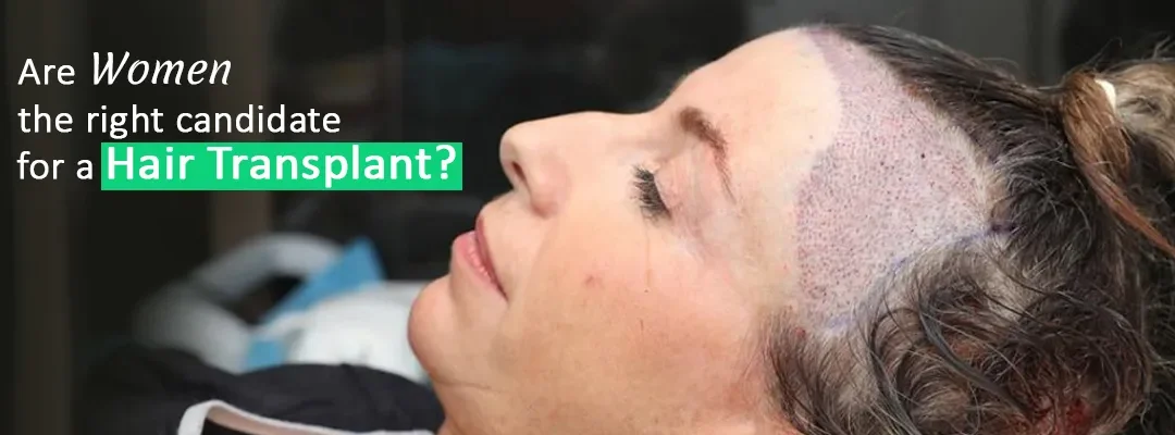Are women the right candidate for a hair transplant?