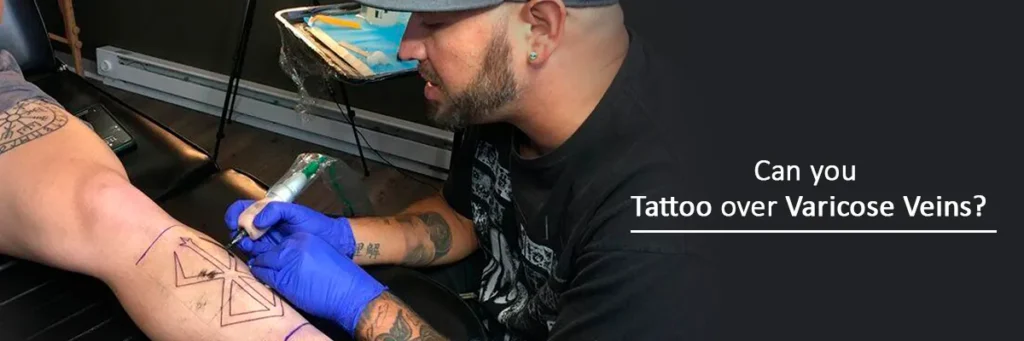 tattoo varicose veins