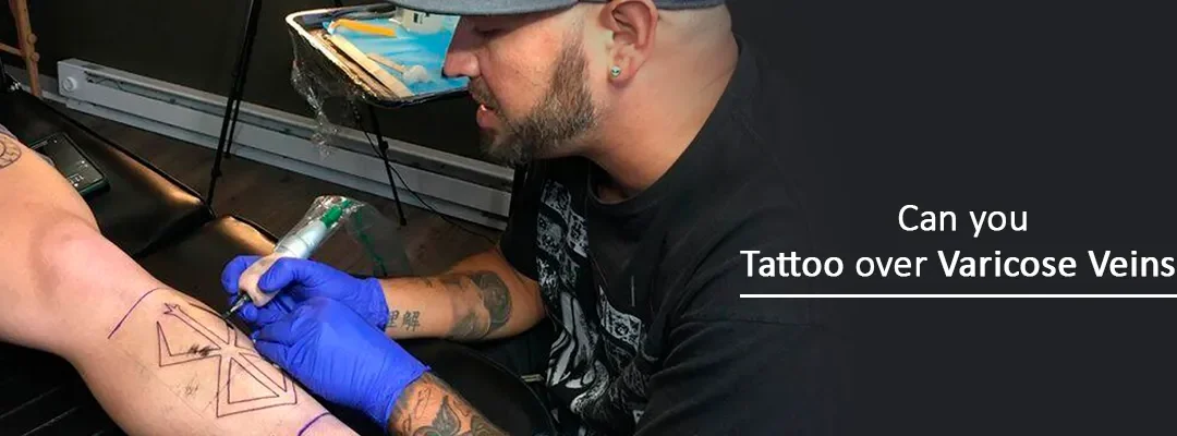 Can you Tattoo over Varicose Veins?