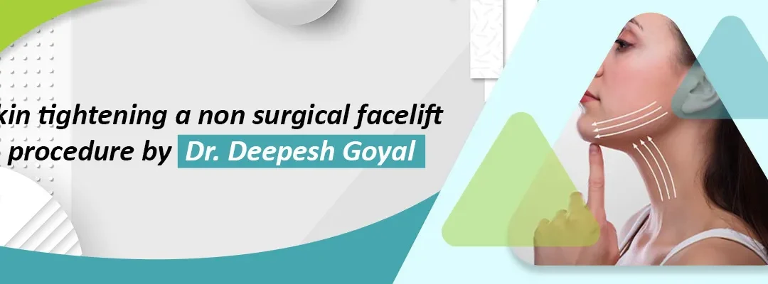 Skin Tightening: A non-surgical facelift procedure | Dr. Deepesh Goyal