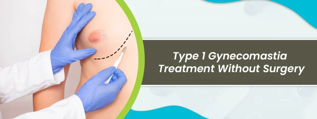 Gynecomastia