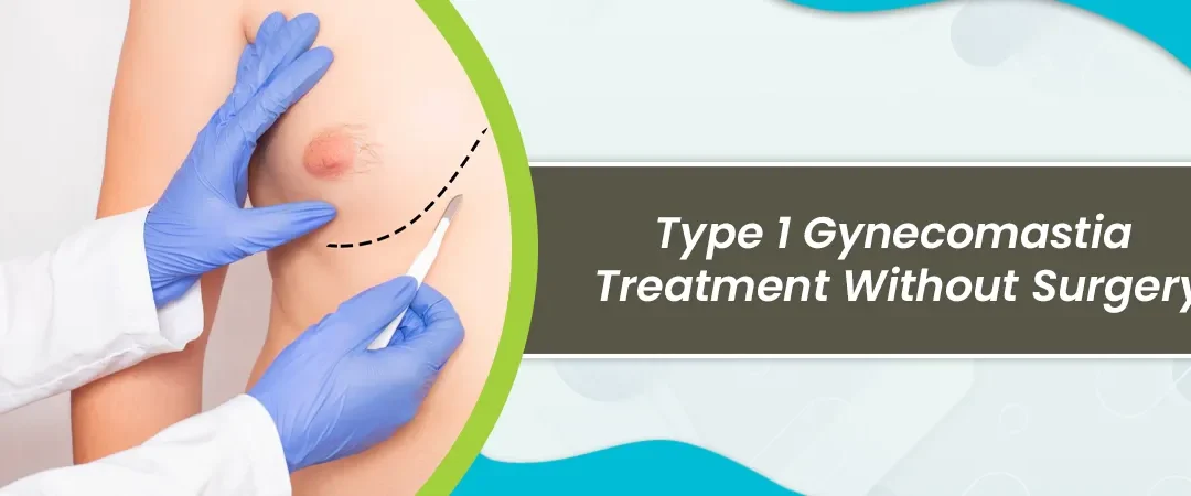Type 1 Gynecomastia treatment without surgery