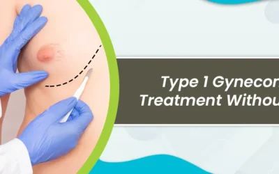 Type 1 Gynecomastia treatment without surgery