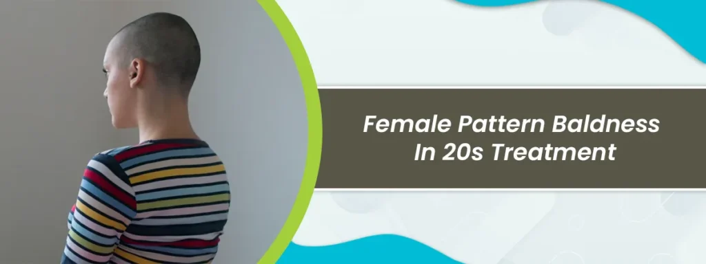 baldness in 20s treatment
