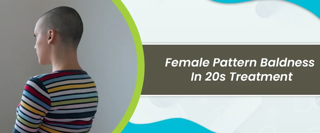 Female Pattern Baldness in 20s Treatment