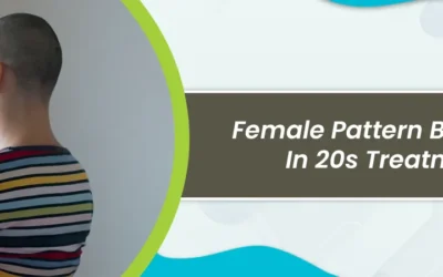 Female Pattern Baldness in 20s Treatment