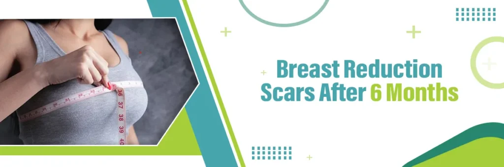 Breast Reduction Scars After 6 Months