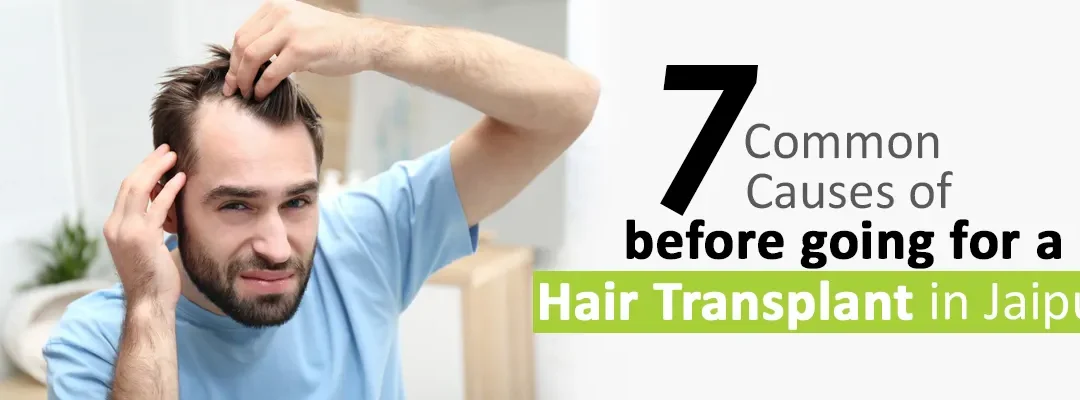 7 Things to Consider before going for a Hair Transplant in Jaipur