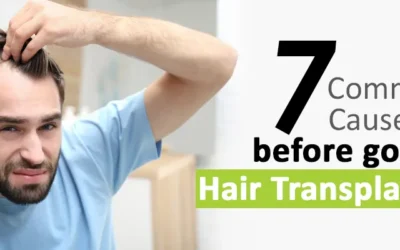 7 Things to Consider before going for a Hair Transplant in Jaipur