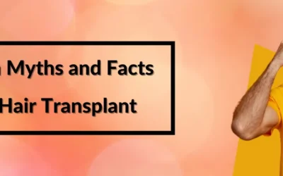8 Common Myths and Facts About Hair Transplant in Jaipur