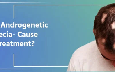 What is Androgenetic Alopecia- Cause & Treatment?