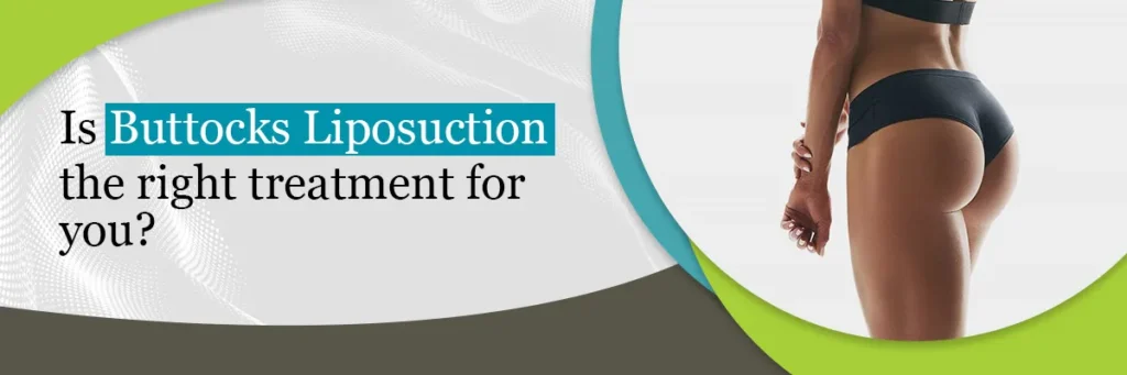 Buttocks Liposuction