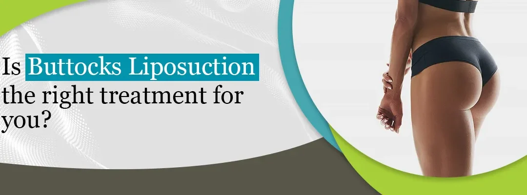 Is Buttocks Liposuction the Right Treatment for You?