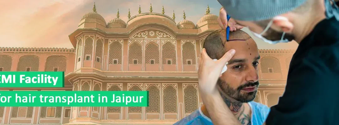 EMI facility for hair transplant in Jaipur
