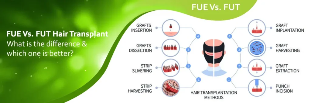 FUE vs FUT hair transplant