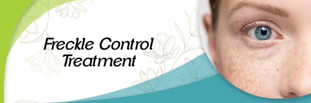 Freckle Control & Treatment