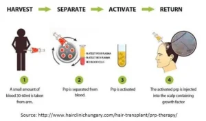How is scalp rejuvenation done? 