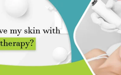 Can I improve my skin with Mesotherapy?