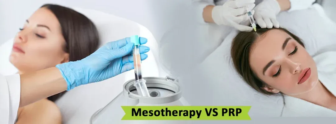 PRP vs Mesotherapy hair treatment