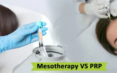 PRP vs Mesotherapy hair treatment
