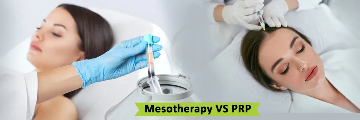 PRP vs Mesotherapy hair treatment
