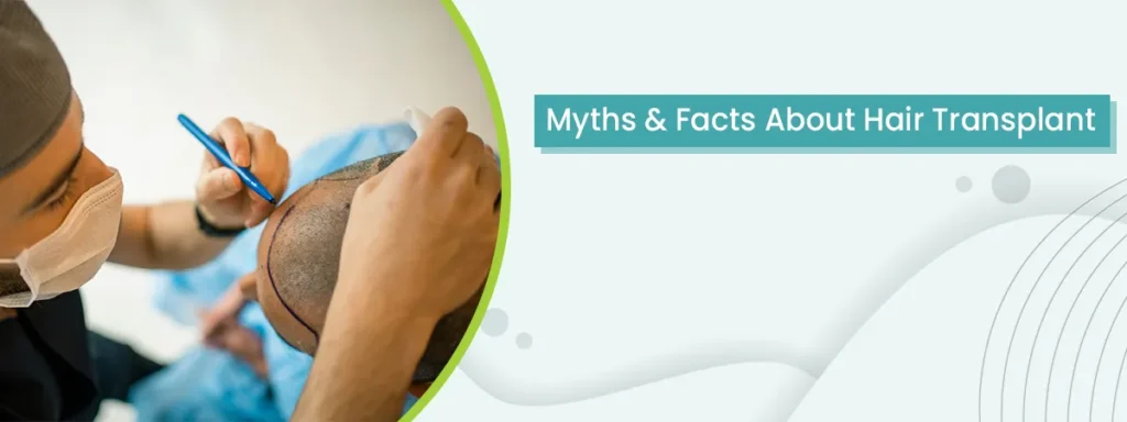 Myth about hair transplant