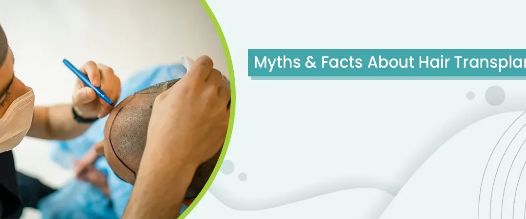 Myths & Facts About Hair Transplant
