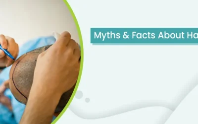 Myths & Facts About Hair Transplant