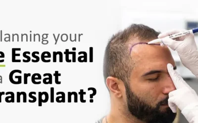 Why is Planning your Hairline Essential for a Great Hair Transplant?