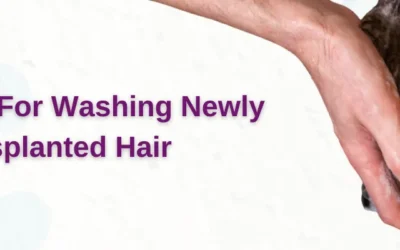 Guidelines for Washing Newly Transplanted Hair | Rejuvena Cosmo Care