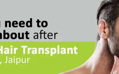 All you need to know about beard hair transplant in Sodala, Jaipur
