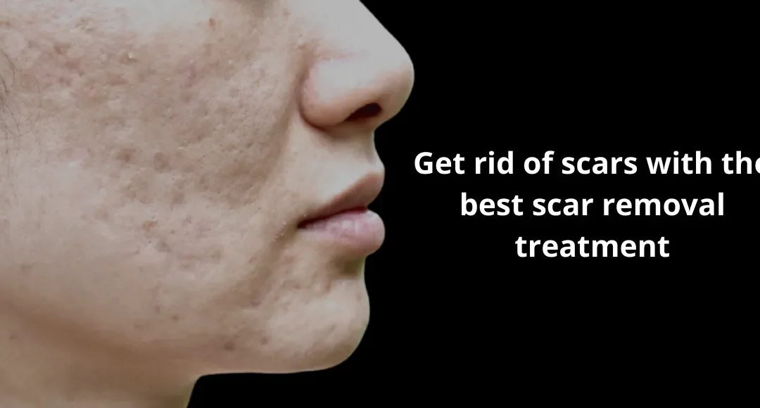How to get rid of facial scars?