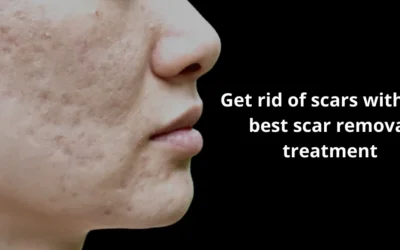 How to get rid of facial scars?