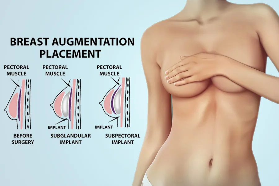 breast augmentation treatment