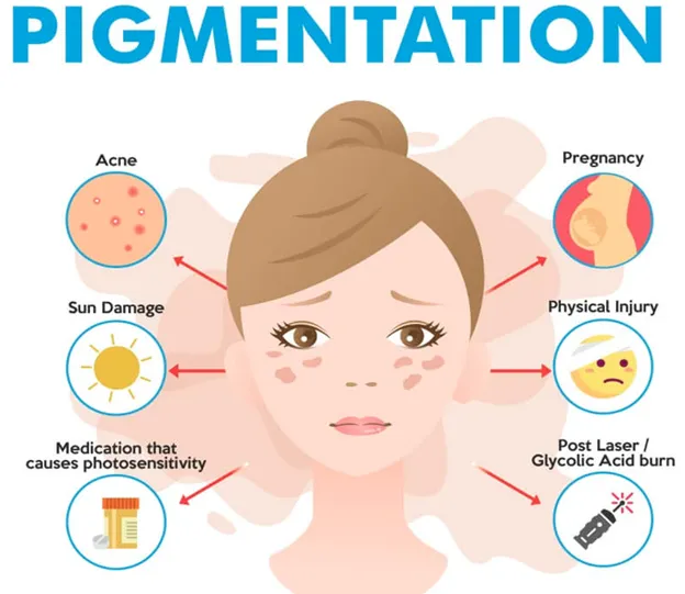 causes pigmentation