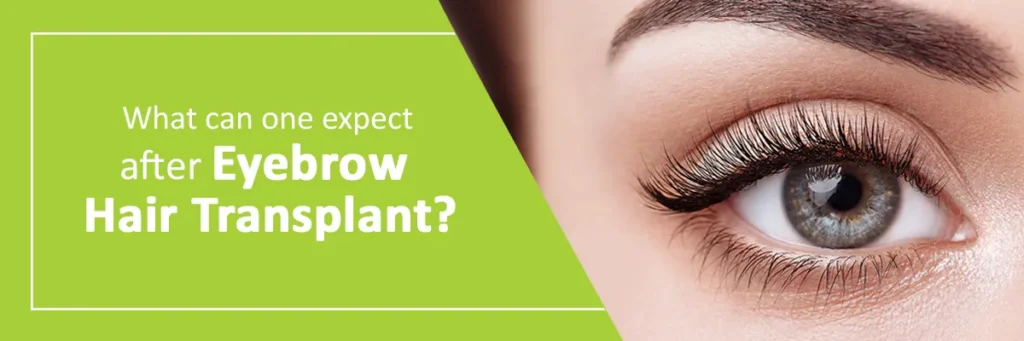 eyebrow hair transplant