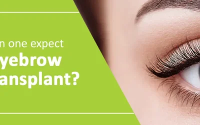 What can one expect after eyebrow hair transplant?