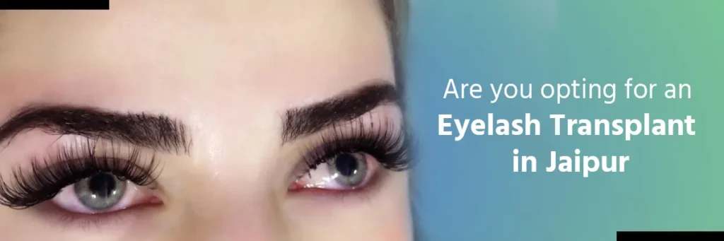 eyelash transplant in Jaipur