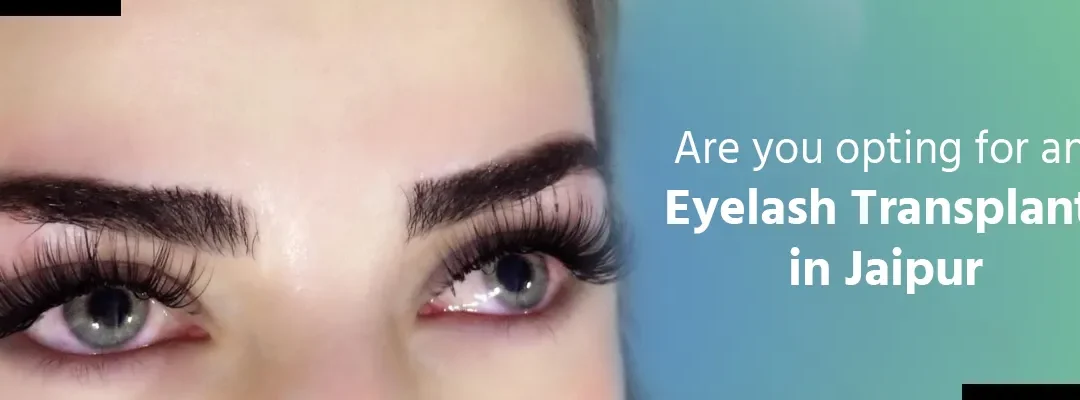Are you opting for an Eyelash Transplant in Jaipur?
