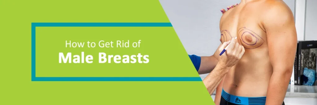 get rid of male breast