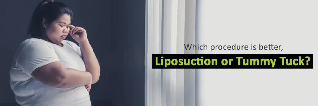 liposuction or tummy tuck