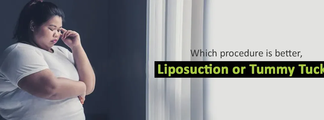 Which procedure is better, Liposuction or Tummy Tuck?