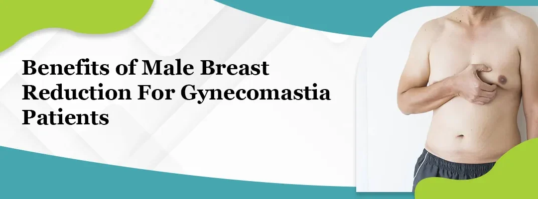 Benefits of Male Breast Reduction For Gynecomastia Patients
