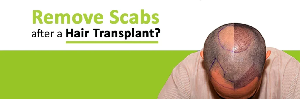 remove scabs