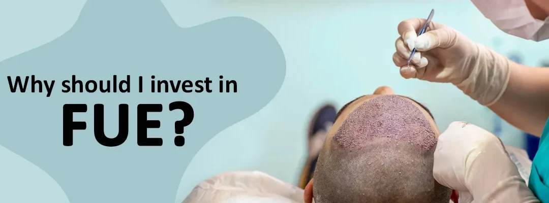 Why should I invest in FUE?