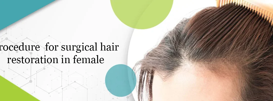 Procedure for surgical hair restoration in female