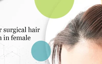 Procedure for surgical hair restoration in female