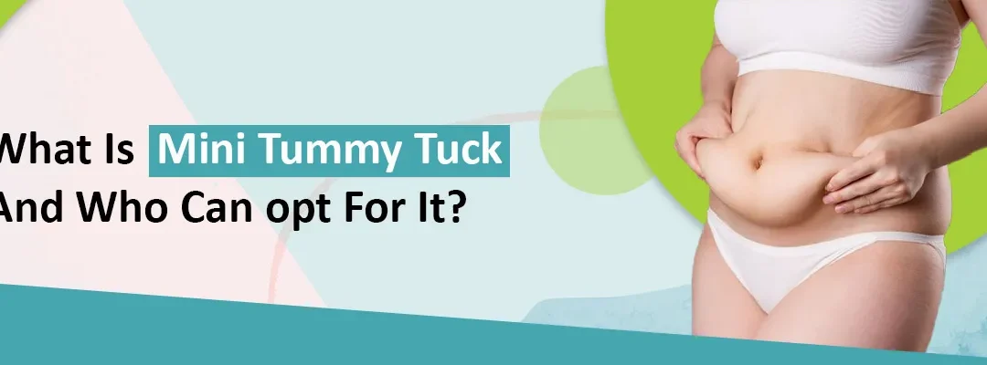What Is Mini Tummy Tuck And Who Can opt For It?