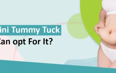 What Is Mini Tummy Tuck And Who Can opt For It?